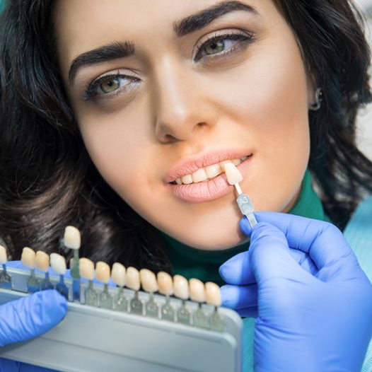 How To Choose The Right Dental Veneers For Your Smile’s Needs?