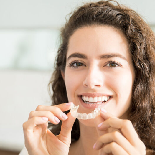 Why is Invisalign the Preferred Choice for Straightening Teeth?