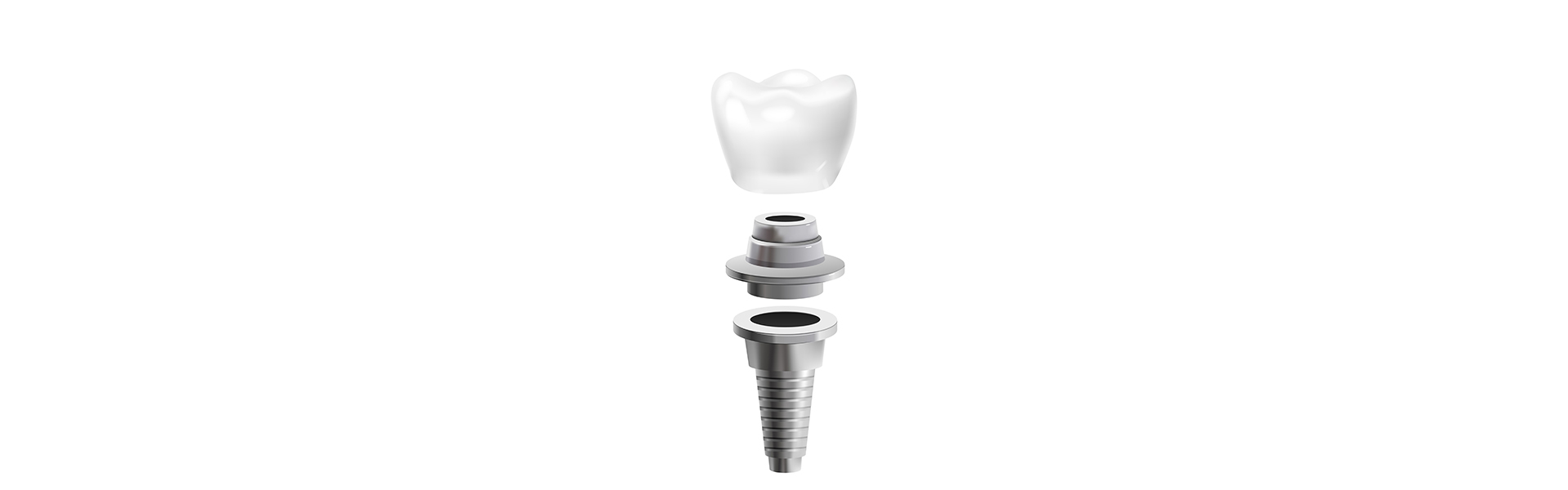 Who Is the Right Candidate for Dental Implants? What You Need to Know