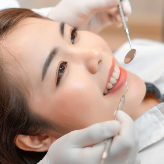 Understand if Dental Bonding Is the Ideal Solution for Your Dental Concerns