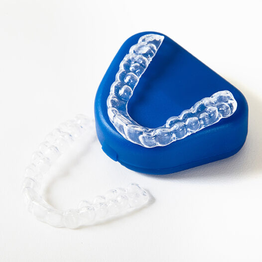 The Benefits of Invisalign for Busy Adults Who Want a Discreet Smile