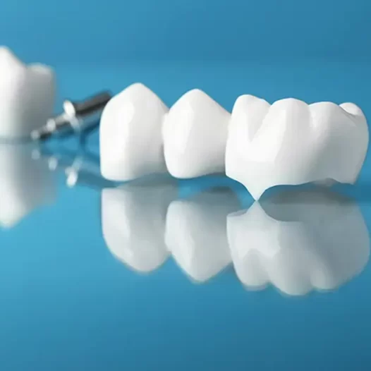 CEREC, Same-Day, and Zirconia Crowns: What Richmond Hill Patients Should Know
